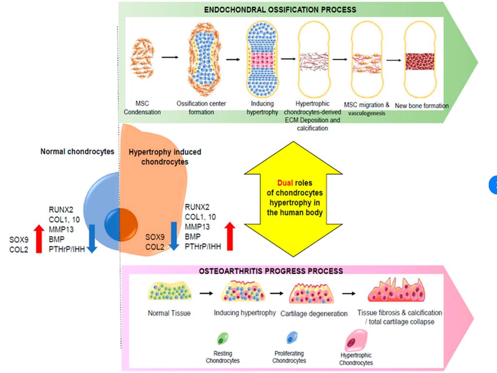 Duálna úloha chondrocytov v ľudskom tele, osteoartritický a osifikačný proces